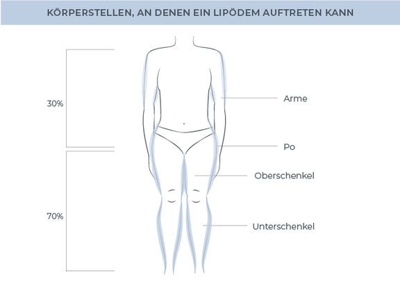 Körperstellen Lipödem, Dr. Fiorella De Nitto, Gefäßchirurgie München